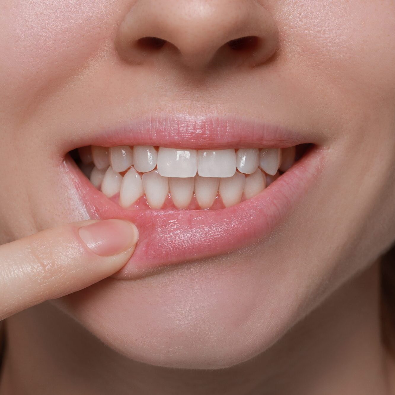 land o' lakes dental implants